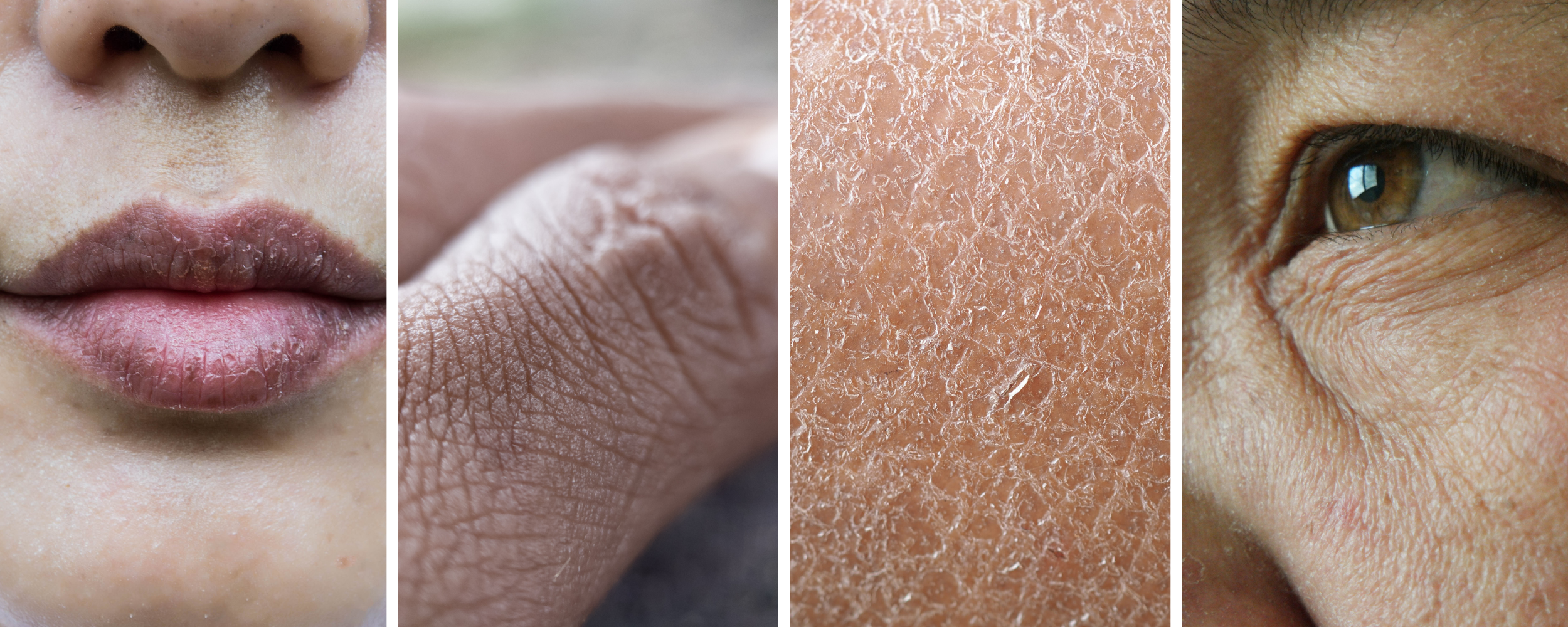 Skin_Collage.jpg