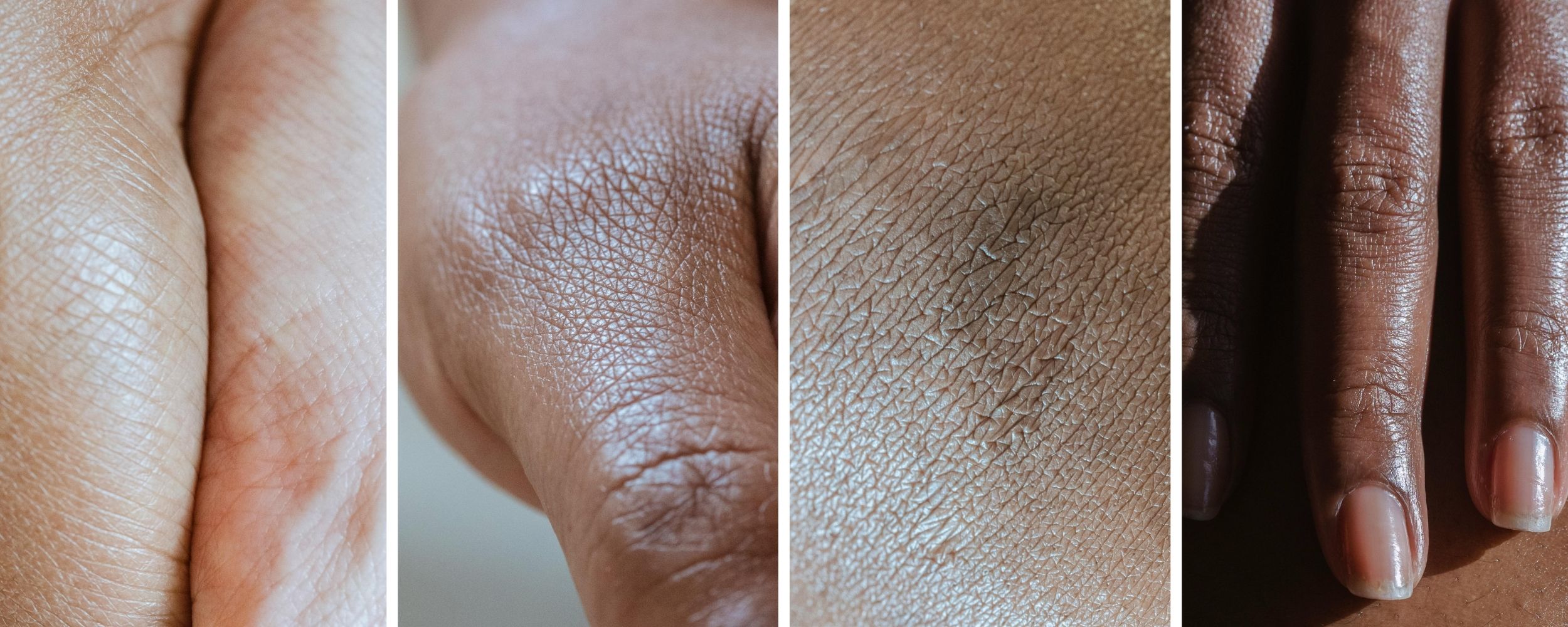 Skin_Collage.jpg